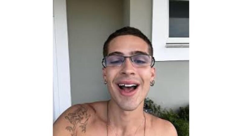 Nova Tendência: João Guilherme adere ao sorriso natural com lentes menos brancas