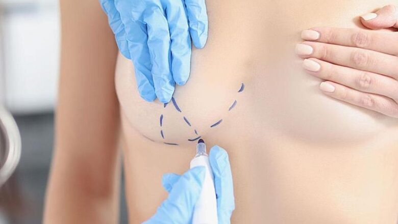 Dr Octavio Curi Frascareli – Cirurgia da mulher moderna: a jovem mãe que se cuida e busca um resultado natural
