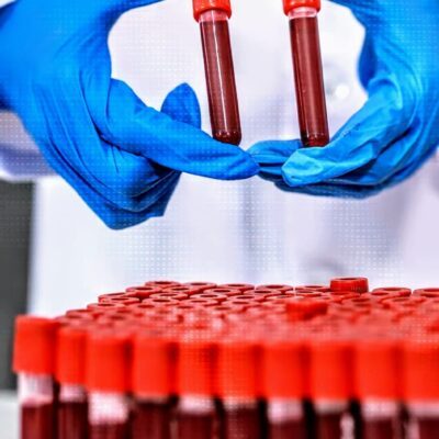 Japão desenvolve sangue artificial compatível com todos os tipos sanguíneos: revolução médica pode chegar aos hospitais até 2030