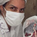 Terapia Bioplacentária: a pesquisa e o protocolo exclusivo da Dra. Silvana Correia ganha destaque internacional