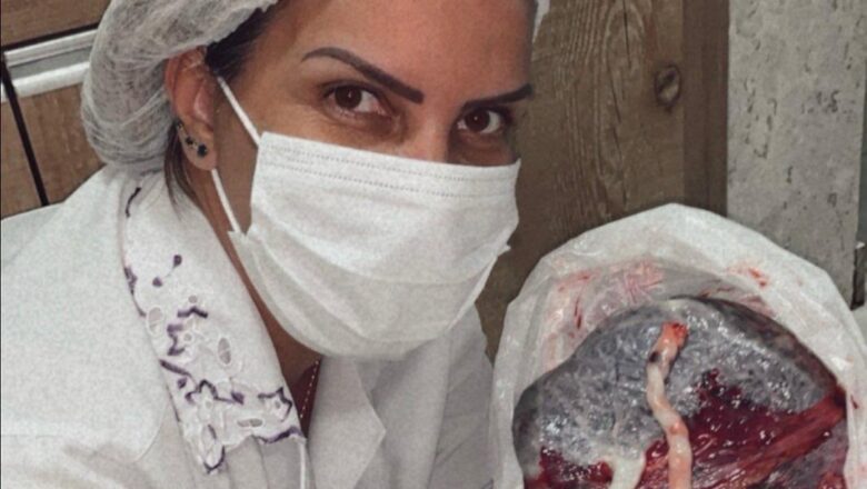 Terapia Bioplacentária: a pesquisa e o protocolo exclusivo da Dra. Silvana Correia ganha destaque internacional